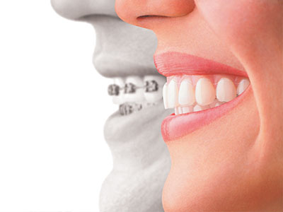 Advanced Dental Arts | Preventative Program, Dentures and Laser Dentistry